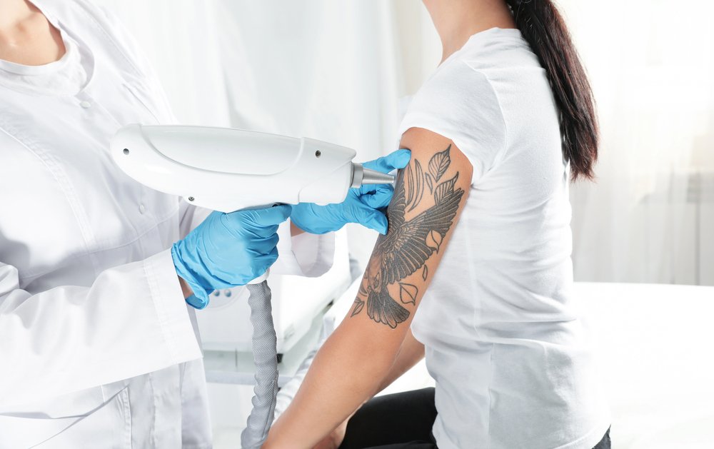 Tatto Removal Clinic